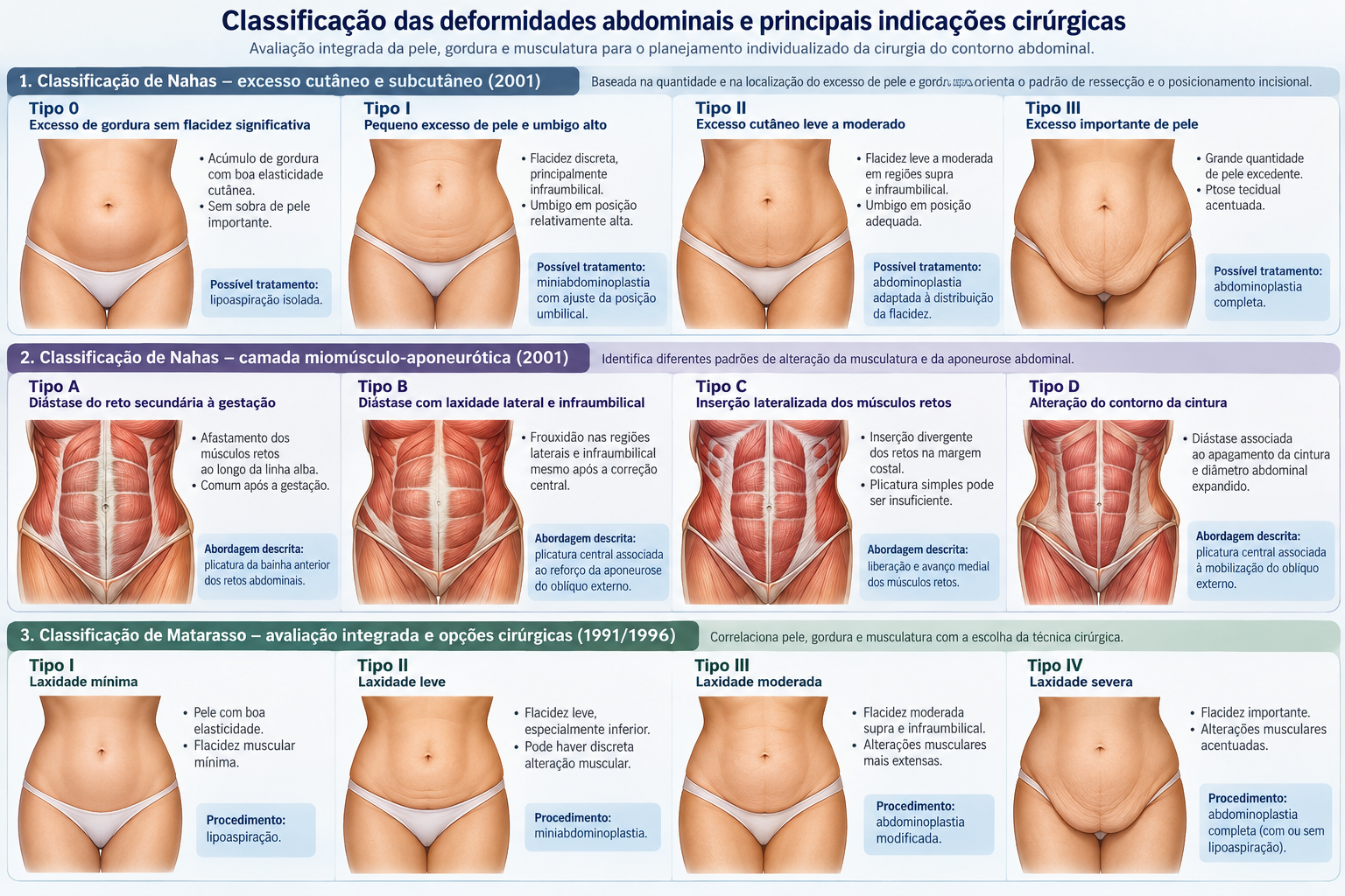 Classificação das deformidades abdominais e opções cirúrgicas